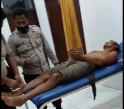 Tersangka curanmor dalam perawatan medis. (Foto: Katajari.com)