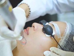 Pico Laser di Poliklinik Kosmetik Medik RSD Idaman Kota Banjarbar
