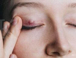 Gejala Muncul Benjolan Asing di Tubuh, Periksakan ke RSD Idaman