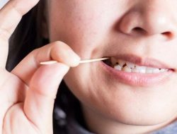 Pesan Dokter Gigi RSD Idaman, Penggunaan Tusuk Gigi Potensial Risiko Kesehatan