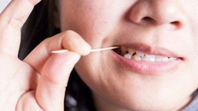 Pesan Dokter Gigi RSD Idaman, Penggunaan Tusuk Gigi Potensial Risiko Kesehatan